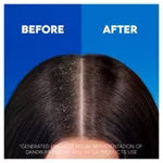Head & Shoulders Classic Clean Clarifying Anti Dandruff Shampoo For Itchy, Dry Scalp And Hair-400ML