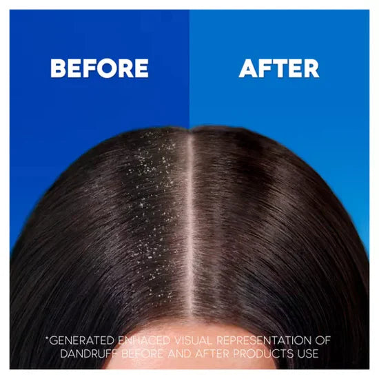 Head & Shoulders Apple Fresh 2in1 Anti-Dandruff Shampoo and Conditioner For Dry Hair And Scalp-400ML